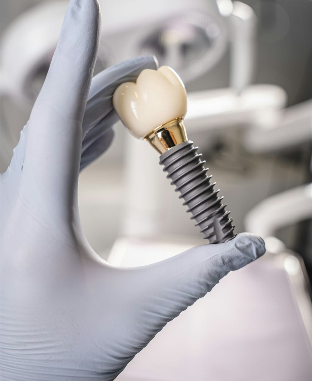 A gloved hand holding a dental implant and crown